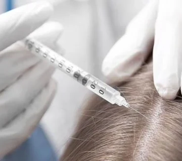 کربوکسی‌تراپی (Carboxytherapy)