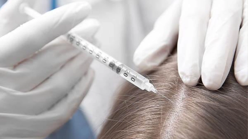 کربوکسی‌تراپی (Carboxytherapy)