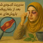 مدیریت کبودی شدید بعد از بلفاروپلاستی با روش‌های علمی