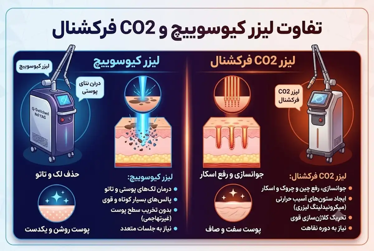 تفاوت لیزر کیوسوییچ و CO2 فرکشنال