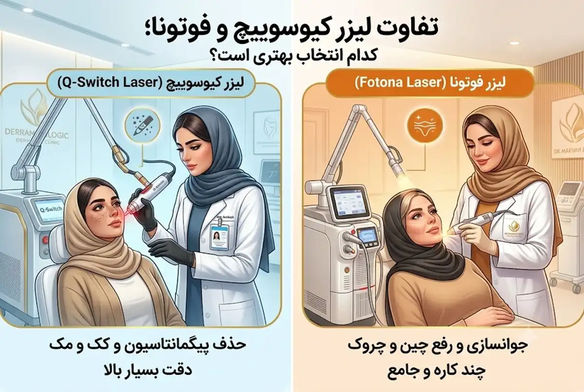 تفاوت لیزر کیوسوییچ و فوتونا؛ کدام انتخاب بهتری است؟