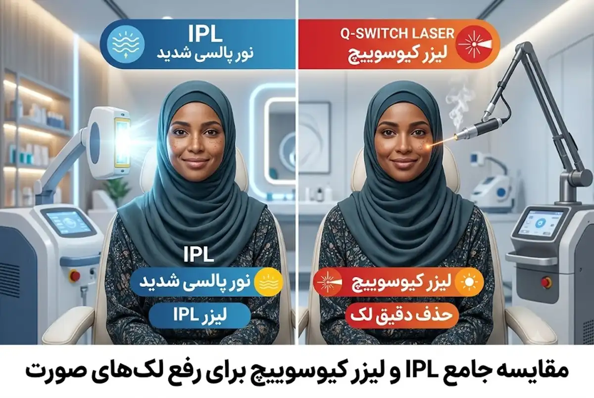 مقایسه کامل IPL و لیزر کیوسوییچ برای رفع لکهای صورت