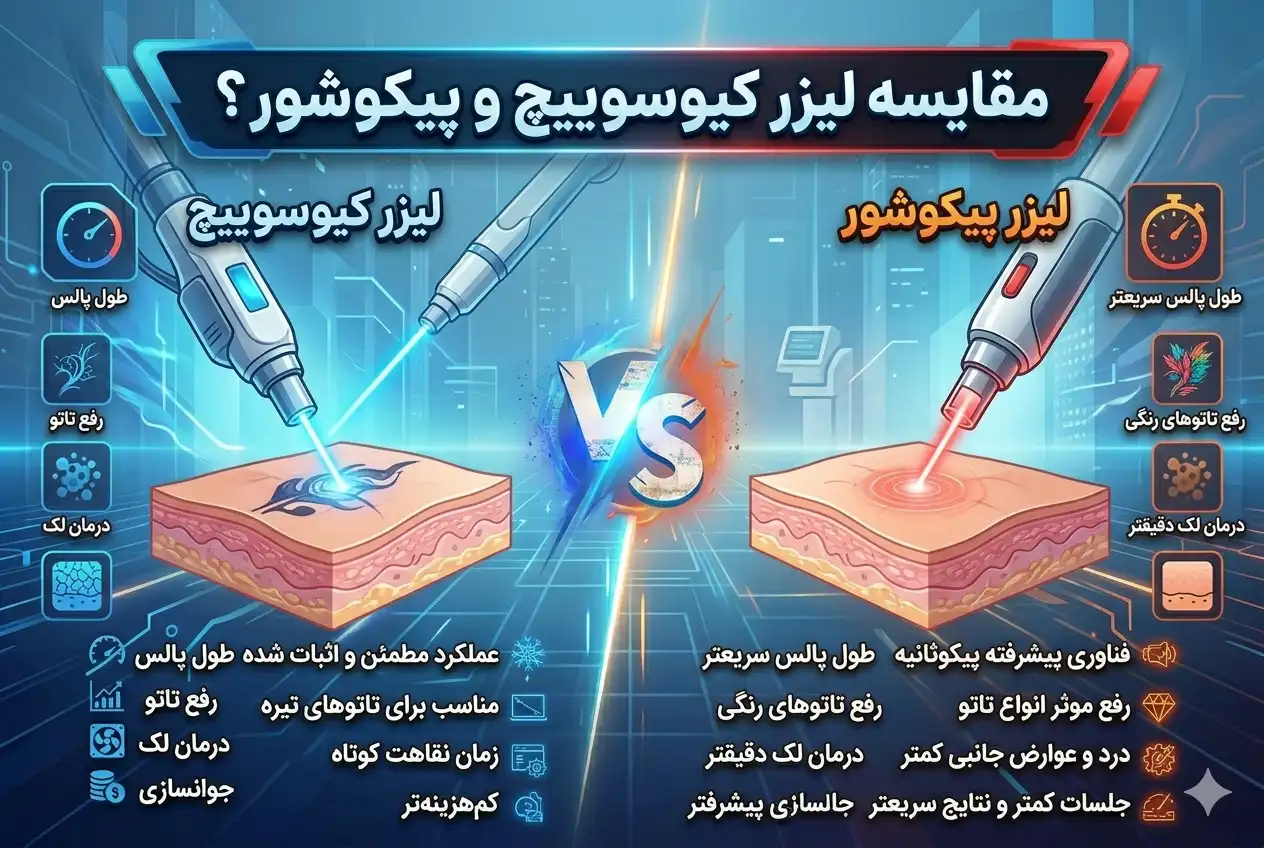 لیزر کیوسوییچ بهتر است یا پیکوشور؟