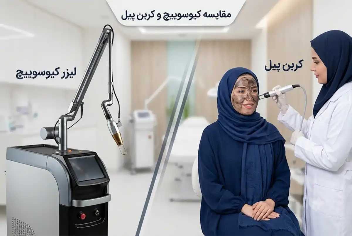 چه زمانی کیوسوییچ بهتر از کربن پیل عمل می کند؟
