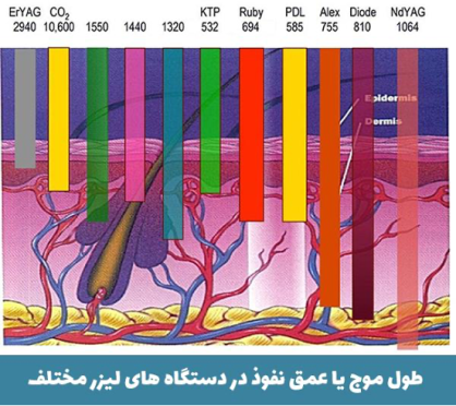 دستگاه الیت پلاس سایناشور، با دو طول موج الکساندرایت و ان‌دی‌یاگ، برای طیف وسیعی از درمان‌ها کاربرد دارد.