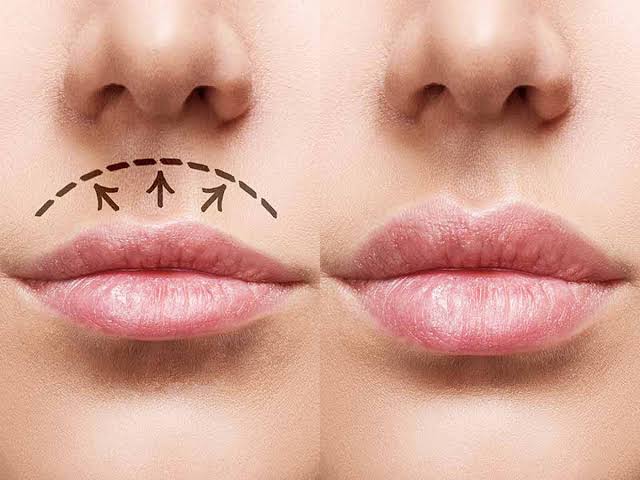 مراقبت‌های بعد از سانترال لب