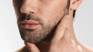 کاشت ریش و سبیل