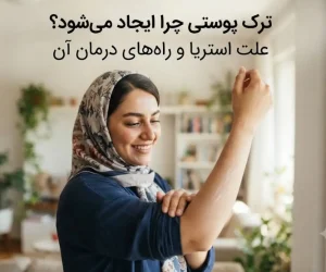 ترک پوستی چرا ایجاد می‌شود؟ علت استریا و راه‌ های درمان آن