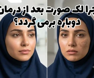 چرا لک صورت بعد از درمان دوباره برمی گردد؟