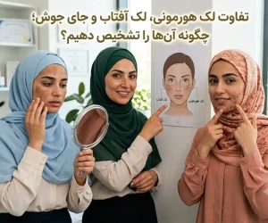 تفاوت لک هورمونی، لک آفتاب و جای جوش؛ چگونه آن‌ها را تشخیص دهیم؟
