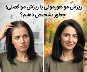 ریزش مو هورمونی یا ریزش مو فصلی؛ چطور تشخیص دهیم؟