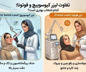 تفاوت لیزر کیوسوییچ و فوتونا؛ کدام انتخاب بهتری است؟