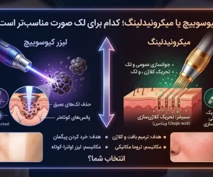 کیوسوییچ یا میکرونیدلینگ؛ کدام برای لک صورت مناسب‌تر است